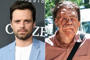 Sebastian Stan Unrecognizable on Set of A Different Man
